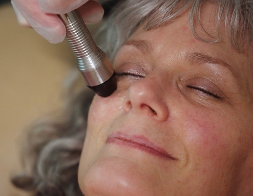 Woman receiving Forma I radiofrequency – dry eye treatment – Meibomian